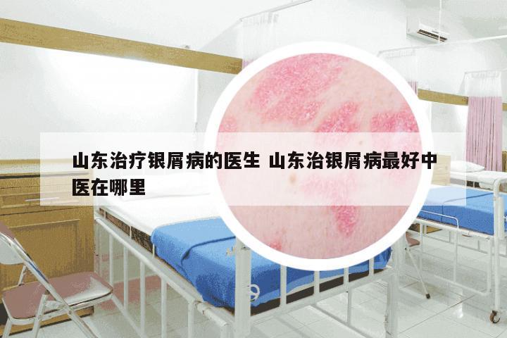 山东治疗银屑病的医生 山东治银屑病最好中医在哪里