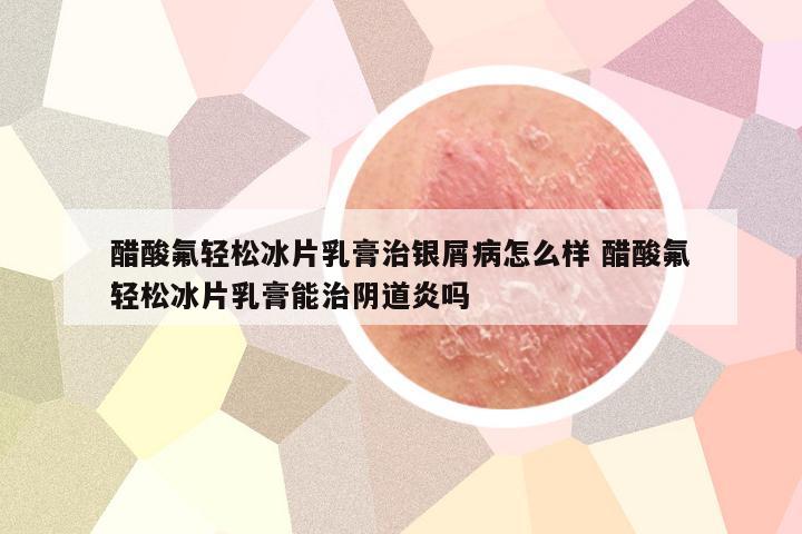 醋酸氟轻松冰片乳膏治银屑病怎么样 醋酸氟轻松冰片乳膏能治阴道炎吗