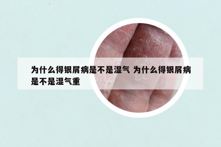 为什么得银屑病是不是湿气 为什么得银屑病是不是湿气重
