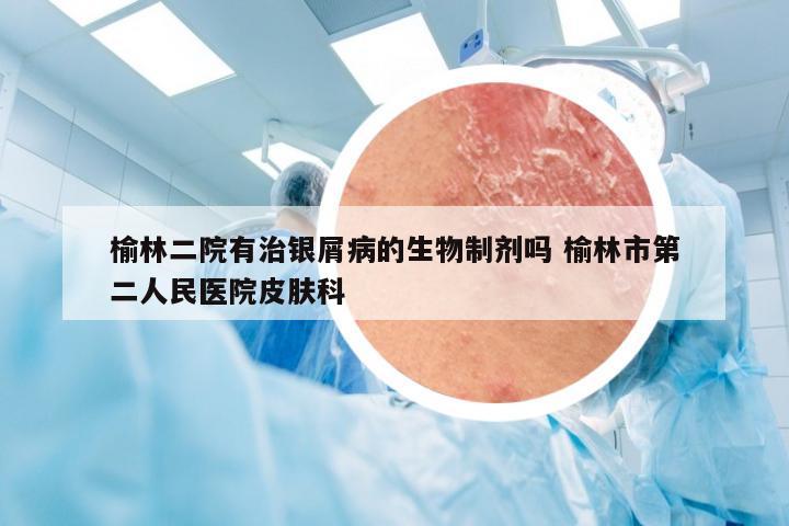 榆林二院有治银屑病的生物制剂吗 榆林市第二人民医院皮肤科