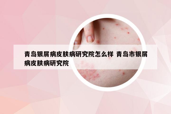 青岛银屑病皮肤病研究院怎么样 青岛市银屑病皮肤病研究院