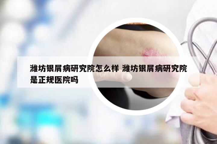 潍坊银屑病研究院怎么样 潍坊银屑病研究院是正规医院吗