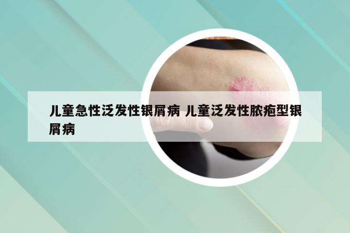 儿童急性泛发性银屑病 儿童泛发性脓疱型银屑病