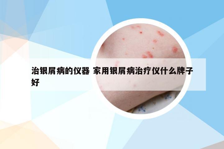 治银屑病的仪器 家用银屑病治疗仪什么牌子好