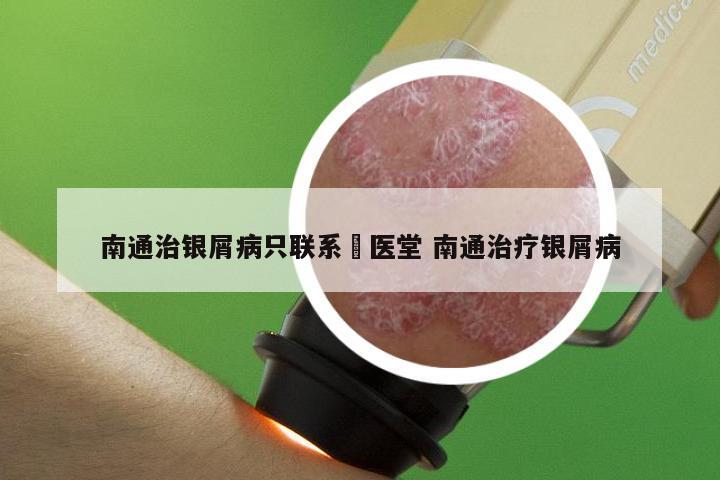 南通治银屑病只联系崋医堂 南通治疗银屑病