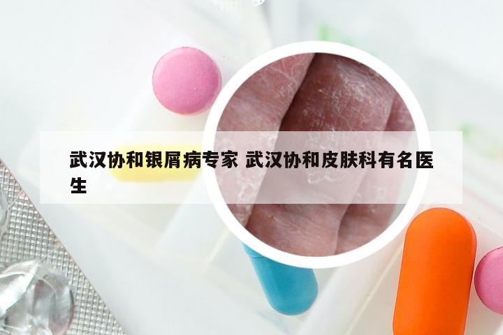 武汉协和银屑病专家 武汉协和皮肤科有名医生