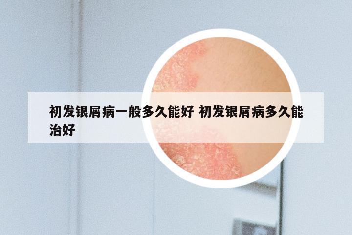 初发银屑病一般多久能好 初发银屑病多久能治好