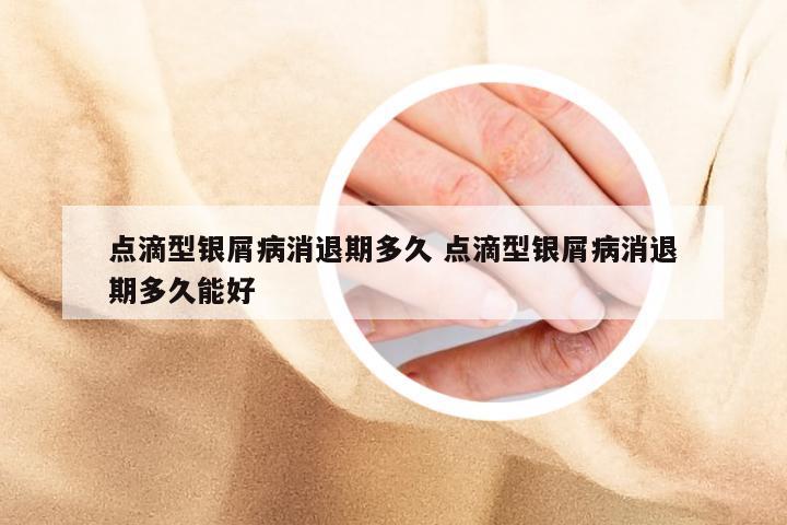 点滴型银屑病消退期多久 点滴型银屑病消退期多久能好