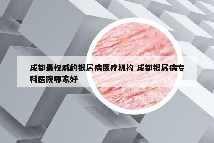 成都最权威的银屑病医疗机构 成都银屑病专科医院哪家好