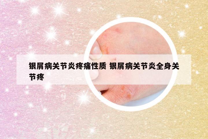 银屑病关节炎疼痛性质 银屑病关节炎全身关节疼