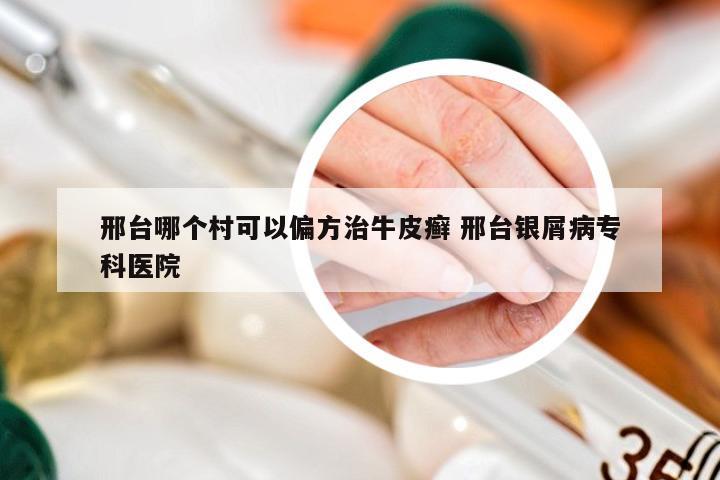 邢台哪个村可以偏方治牛皮癣 邢台银屑病专科医院