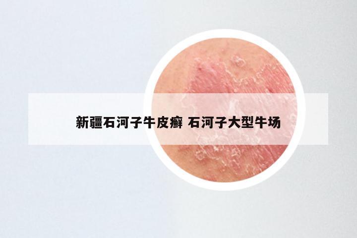 新疆石河子牛皮癣 石河子大型牛场