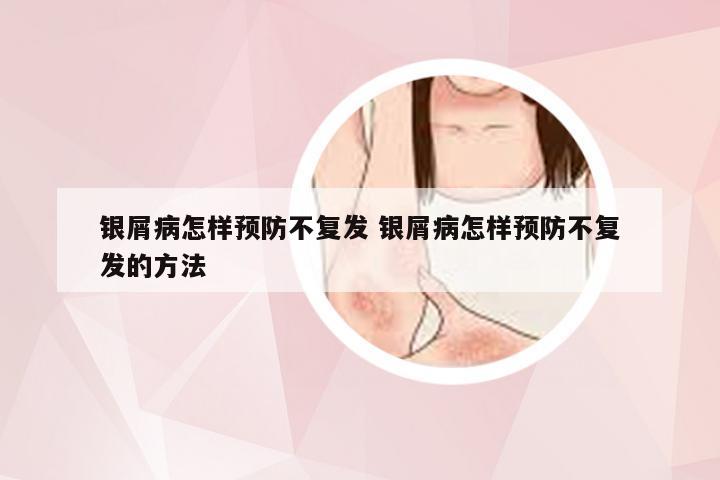 银屑病怎样预防不复发 银屑病怎样预防不复发的方法