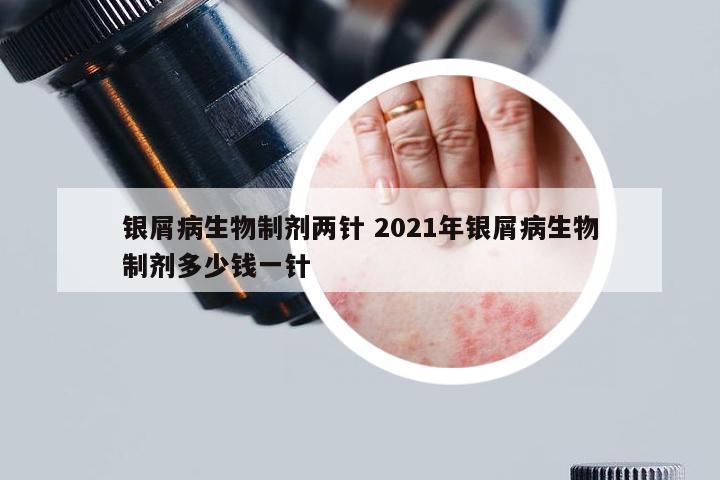 银屑病生物制剂两针 2021年银屑病生物制剂多少钱一针