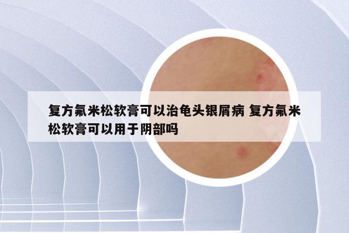 复方氟米松软膏可以治龟头银屑病 复方氟米松软膏可以用于阴部吗
