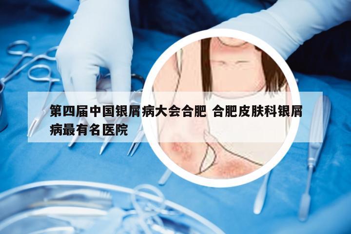 第四届中国银屑病大会合肥 合肥皮肤科银屑病最有名医院