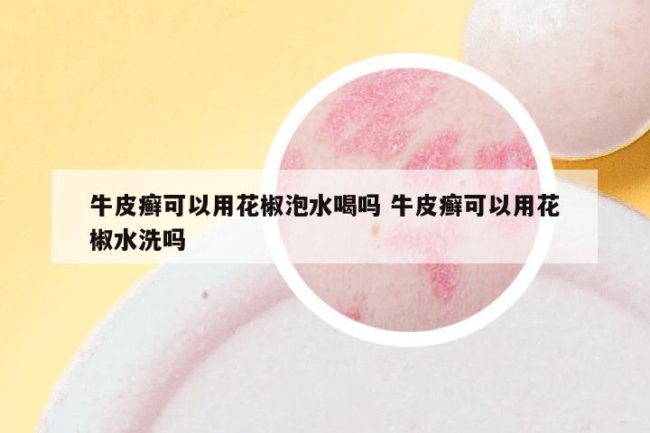 牛皮癣可以用花椒泡水喝吗 牛皮癣可以用花椒水洗吗