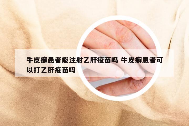 牛皮癣患者能注射乙肝疫苗吗 牛皮癣患者可以打乙肝疫苗吗