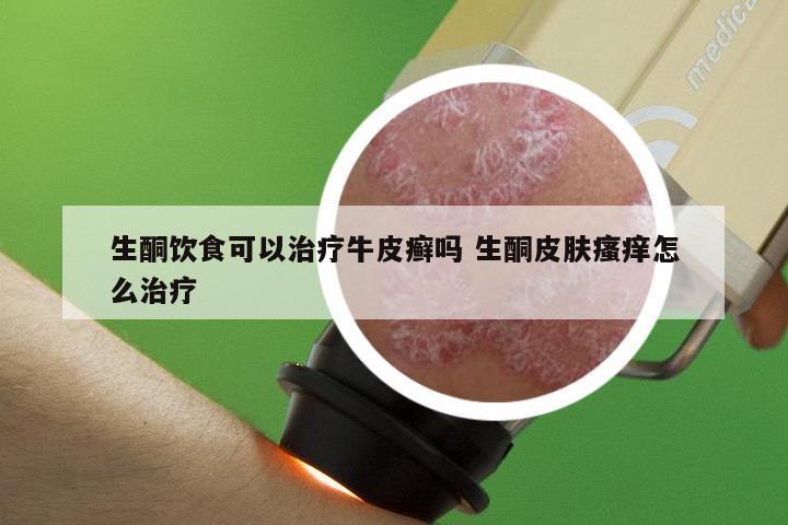 生酮饮食可以治疗牛皮癣吗 生酮皮肤瘙痒怎么治疗