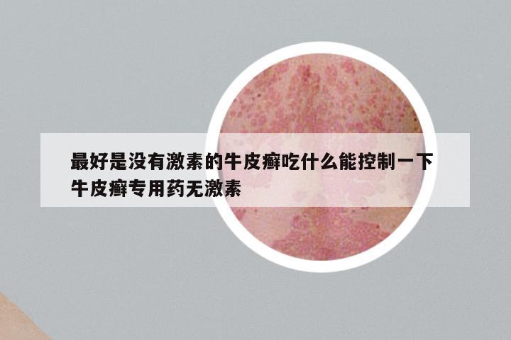 最好是没有激素的牛皮癣吃什么能控制一下 牛皮癣专用药无激素