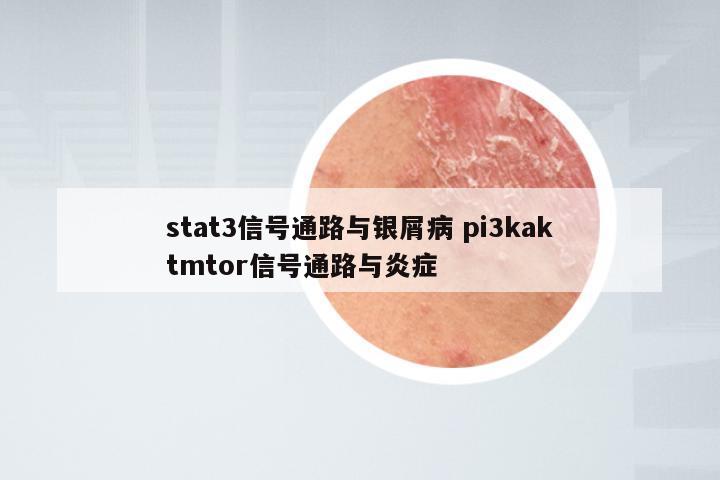 stat3信号通路与银屑病 pi3kaktmtor信号通路与炎症