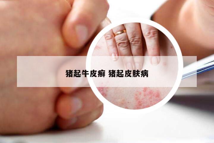 猪起牛皮癣 猪起皮肤病
