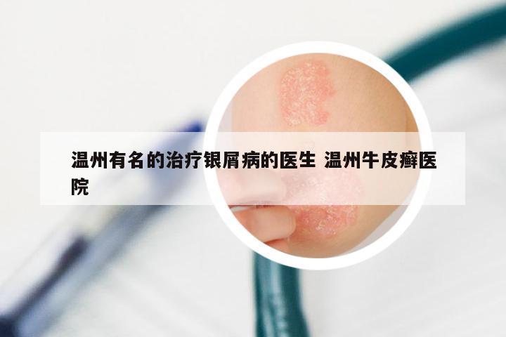 温州有名的治疗银屑病的医生 温州牛皮癣医院