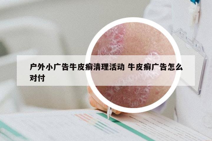 户外小广告牛皮癣清理活动 牛皮癣广告怎么对付