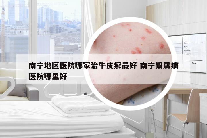 南宁地区医院哪家治牛皮癣最好 南宁银屑病医院哪里好