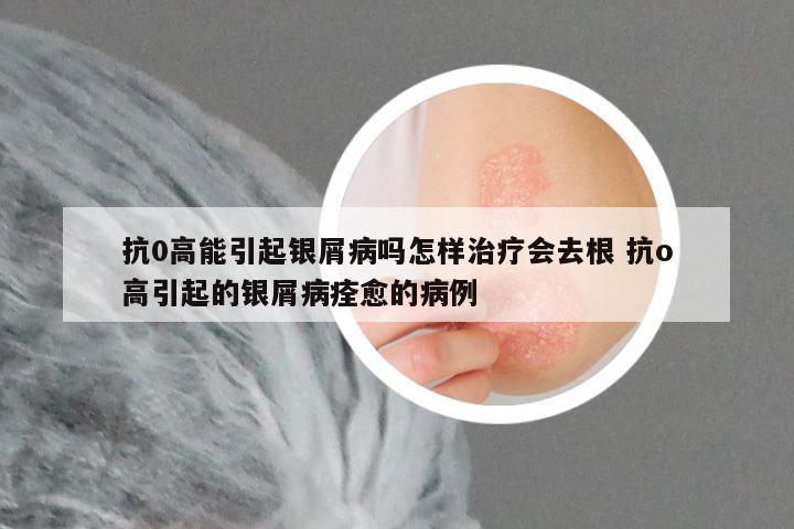 抗0高能引起银屑病吗怎样治疗会去根 抗o高引起的银屑病痊愈的病例