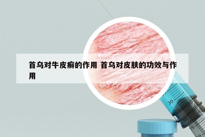 首乌对牛皮癣的作用 首乌对皮肤的功效与作用