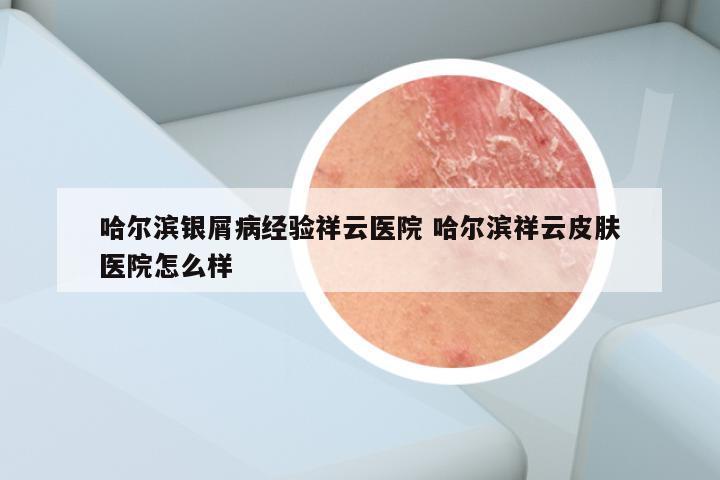 哈尔滨银屑病经验祥云医院 哈尔滨祥云皮肤医院怎么样