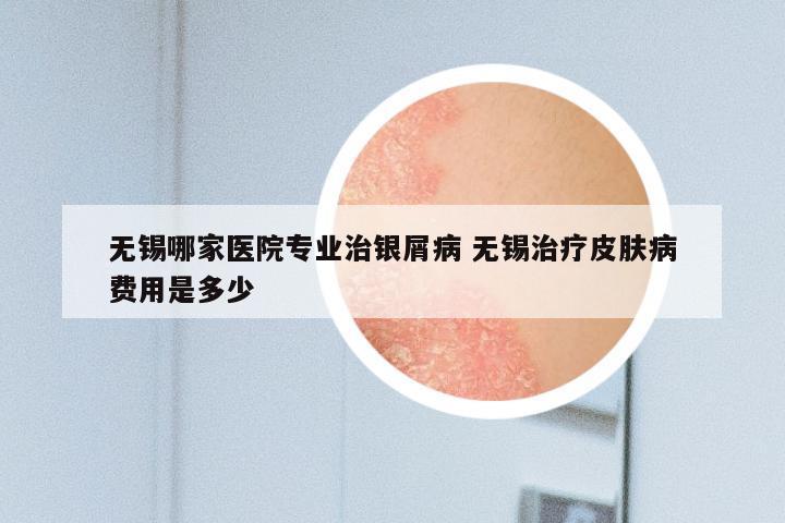 无锡哪家医院专业治银屑病 无锡治疗皮肤病费用是多少
