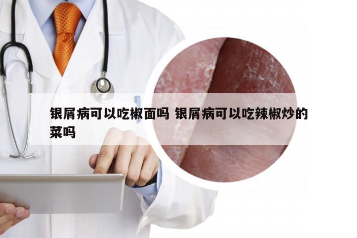 银屑病可以吃椒面吗 银屑病可以吃辣椒炒的菜吗