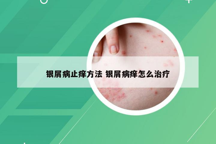 银屑病止痒方法 银屑病痒怎么治疗