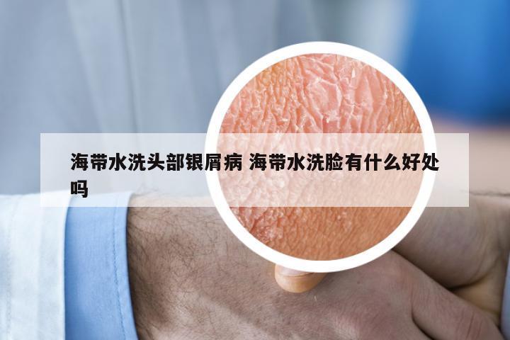 海带水洗头部银屑病 海带水洗脸有什么好处吗