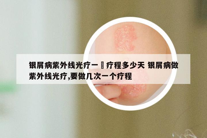 银屑病紫外线光疗一亇疗程多少天 银屑病做紫外线光疗,要做几次一个疗程