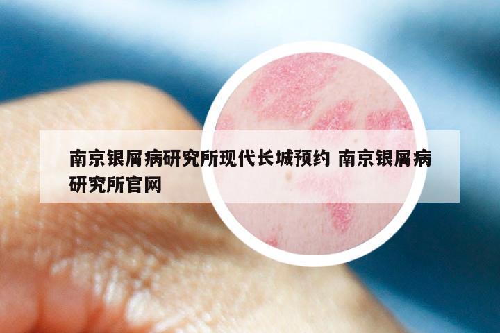 南京银屑病研究所现代长城预约 南京银屑病研究所官网