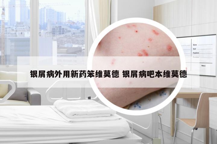 银屑病外用新药笨维莫德 银屑病吧本维莫德