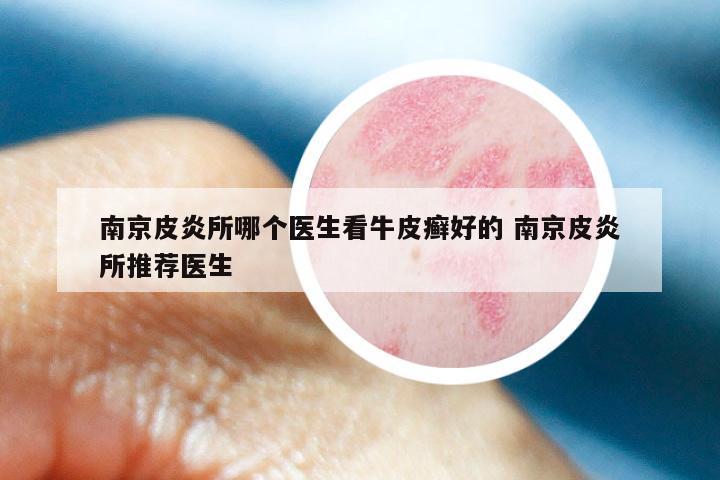 南京皮炎所哪个医生看牛皮癣好的 南京皮炎所推荐医生