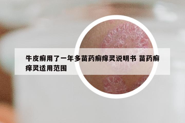 牛皮癣用了一年多苗药癣痒灵说明书 苗药癣痒灵适用范围