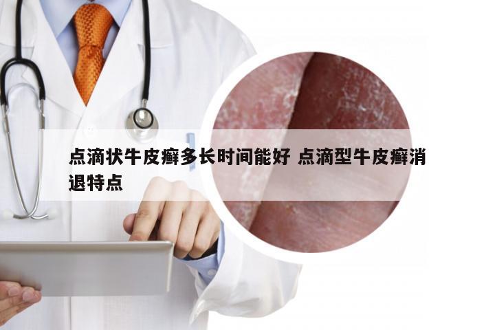 点滴状牛皮癣多长时间能好 点滴型牛皮癣消退特点