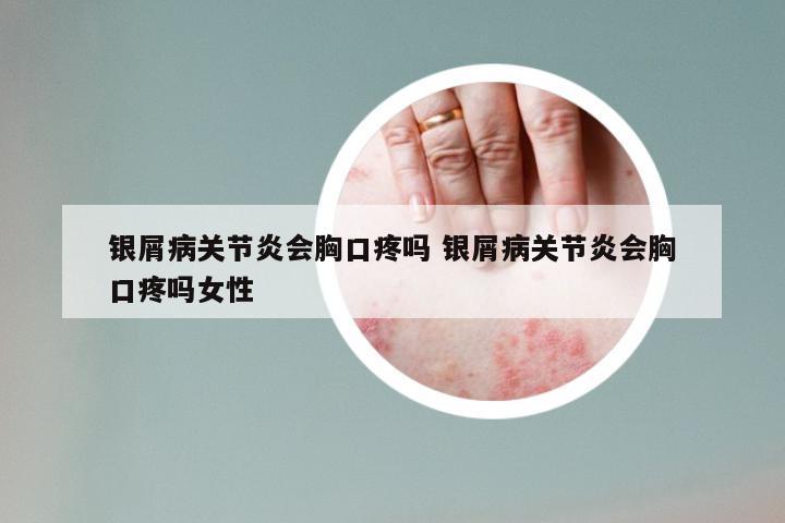 银屑病关节炎会胸口疼吗 银屑病关节炎会胸口疼吗女性