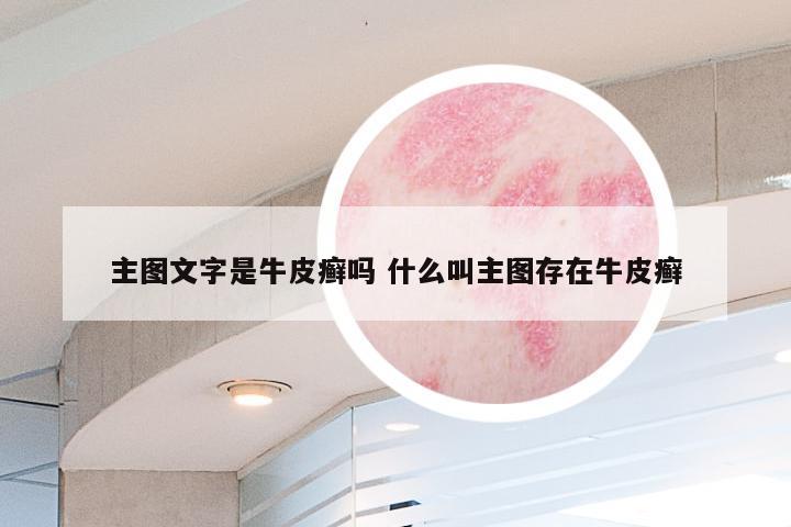 主图文字是牛皮癣吗 什么叫主图存在牛皮癣