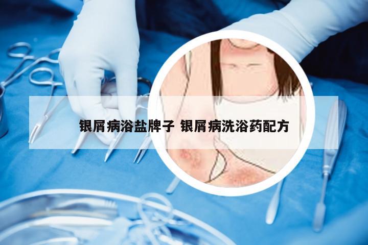 银屑病浴盐牌子 银屑病洗浴药配方
