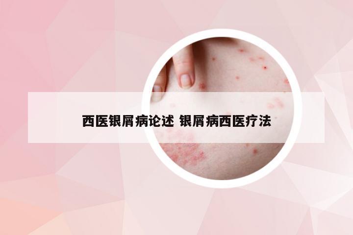 西医银屑病论述 银屑病西医疗法