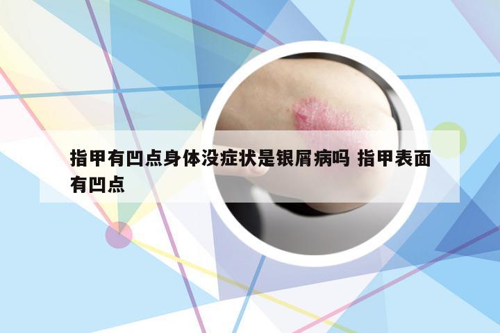 指甲有凹点身体没症状是银屑病吗 指甲表面有凹点