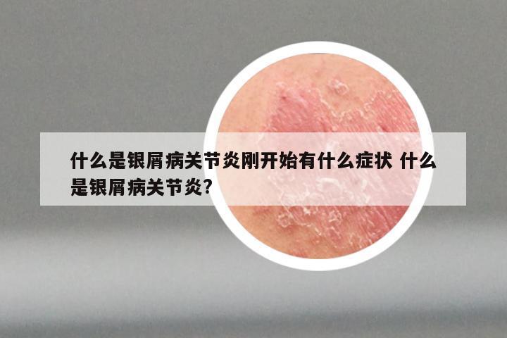 什么是银屑病关节炎刚开始有什么症状 什么是银屑病关节炎?