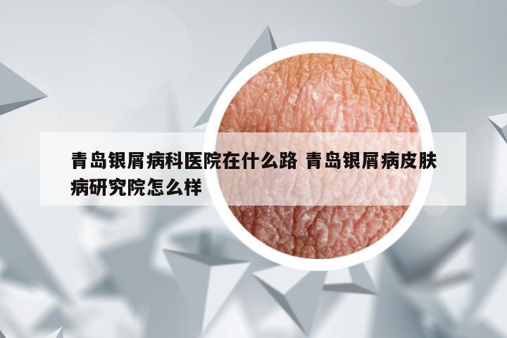 青岛银屑病科医院在什么路 青岛银屑病皮肤病研究院怎么样
