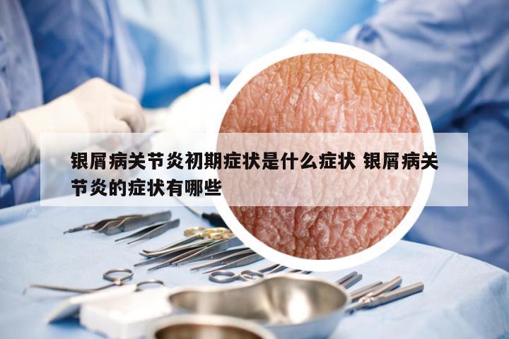 银屑病关节炎初期症状是什么症状 银屑病关节炎的症状有哪些